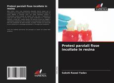 Bookcover of Protesi parziali fisse incollate in resina