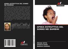 Bookcover of APNEA OSTRUTTIVA DEL SONNO NEI BAMBINI