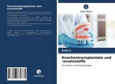 Bookcover of Knochentransplantate und -ersatzstoffe