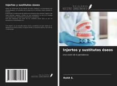 Bookcover of Injertos y sustitutos óseos