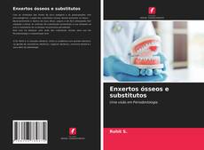 Bookcover of Enxertos ósseos e substitutos