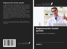 Bookcover of Regeneración tisular guiada