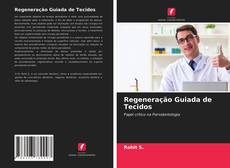 Bookcover of Regeneração Guiada de Tecidos