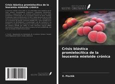 Bookcover of Crisis blástica promielocítica de la leucemia mieloide crónica