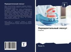 Buchcover von Пародонтальный лоскут