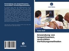 Bookcover of Anwendung von langwirksamen, reversiblen Verhütungsmethoden