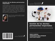 Bookcover of Gestión de los dientes permanentes impactados