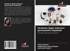 Bookcover of Gestione degli anteriori permanenti impattati