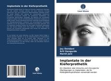 Buchcover von Implantate in der Kieferprothetik