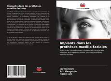 Buchcover von Implants dans les prothèses maxillo-faciales