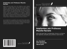 Bookcover of Implantes em Próteses Maxilo-faciais