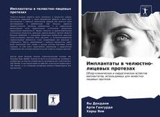 Capa do livro de Имплантаты в челюстно-лицевых протезах 