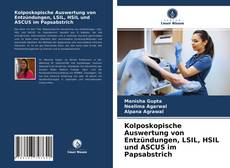 Bookcover of Kolposkopische Auswertung von Entzündungen, LSIL, HSIL und ASCUS im Papsabstrich