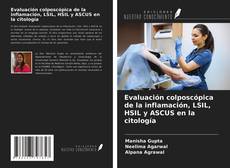 Buchcover von Evaluación colposcópica de la inflamación, LSIL, HSIL y ASCUS en la citología