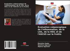 Buchcover von Évaluation colposcopique de l'inflammation, de la LSIL, de la HSIL et de l'ASCUS sur le frottis