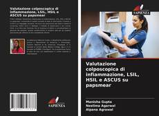 Bookcover of Valutazione colposcopica di infiammazione, LSIL, HSIL e ASCUS su papsmear