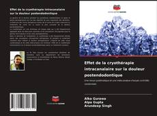 Bookcover of Effet de la cryothérapie intracanalaire sur la douleur postendodontique