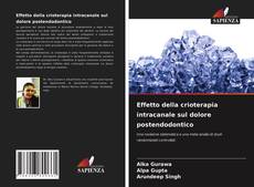 Bookcover of Effetto della crioterapia intracanale sul dolore postendodontico