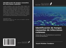 Bookcover of Identificación de hongos causantes de infecciones cutáneas