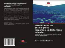 Buchcover von Identification des champignons responsables d'infections cutanées