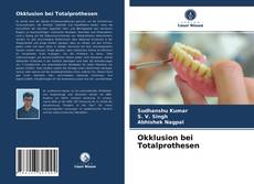 Bookcover of Okklusion bei Totalprothesen