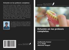 Bookcover of Oclusión en las prótesis completas