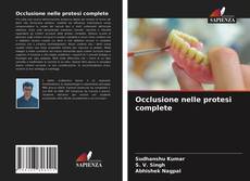 Bookcover of Occlusione nelle protesi complete