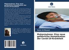 Bookcover of Mukormykose: Eine neue gefährliche Komplikation der Covid-19-Krankheit