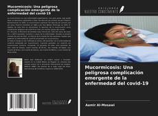 Bookcover of Mucormicosis: Una peligrosa complicación emergente de la enfermedad del covid-19