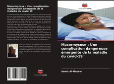 Обложка Mucormycose : Une complication dangereuse émergente de la maladie du covid-19