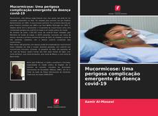 Copertina di Mucormicose: Uma perigosa complicação emergente da doença covid-19