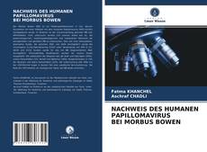 Portada del libro de NACHWEIS DES HUMANEN PAPILLOMAVIRUS BEI MORBUS BOWEN