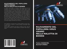 Buchcover von RILEVAMENTO DEL PAPILLOMA VIRUS UMANO NELLA MALATTIA DI BOWEN