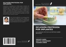 Обложка OCLUSIÓN PROTEGIDA POR IMPLANTES