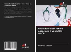 Bookcover of Granulomatosi renale associata a vasculite ANCA