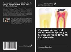 Portada del libro de Comparación entre el localizador de ápices y la técnica de rejilla IOPA: Un Estudio Invivo