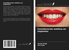 Couverture de Consideración estética en implantes