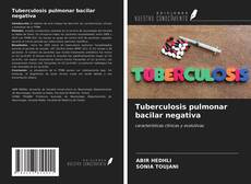 Couverture de Tuberculosis pulmonar bacilar negativa