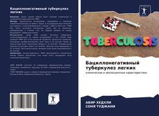 Bookcover of Бациллонегативный туберкулез легких