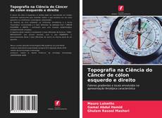 Capa do livro de Topografia na Ciência do Câncer de cólon esquerdo e direito 