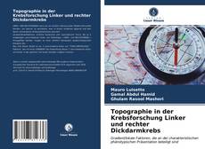 Portada del libro de Topographie in der Krebsforschung Linker und rechter Dickdarmkrebs