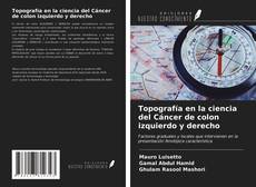 Couverture de Topografía en la ciencia del Cáncer de colon izquierdo y derecho