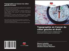 Topographie en Cancer du côlon gauche et droit kitap kapağı