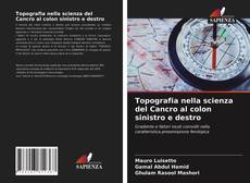 Buchcover von Topografia nella scienza del Cancro al colon sinistro e destro