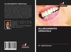 Bookcover of ALLARGAMENTO GENGIVALE