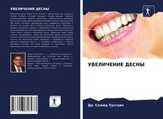 Bookcover of УВЕЛИЧЕНИЕ ДЕСНЫ