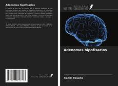 Bookcover of Adenomas hipofisarios