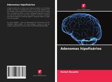 Adenomas hipofisários kitap kapağı