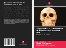 Couverture de Diagnóstico e tratamento de fraturas do meio da face