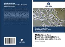 Portada del libro de Metastasiertes Kastrationsresistentes Prostata-adenokarzinom